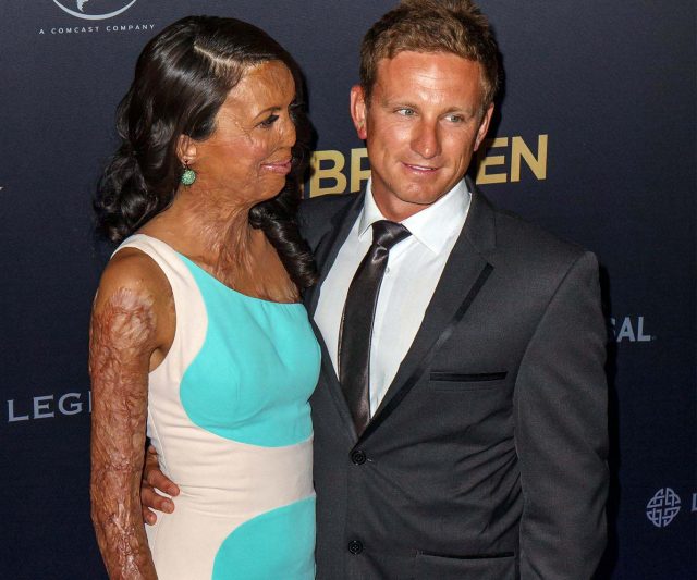 michael hoskin turia pitt