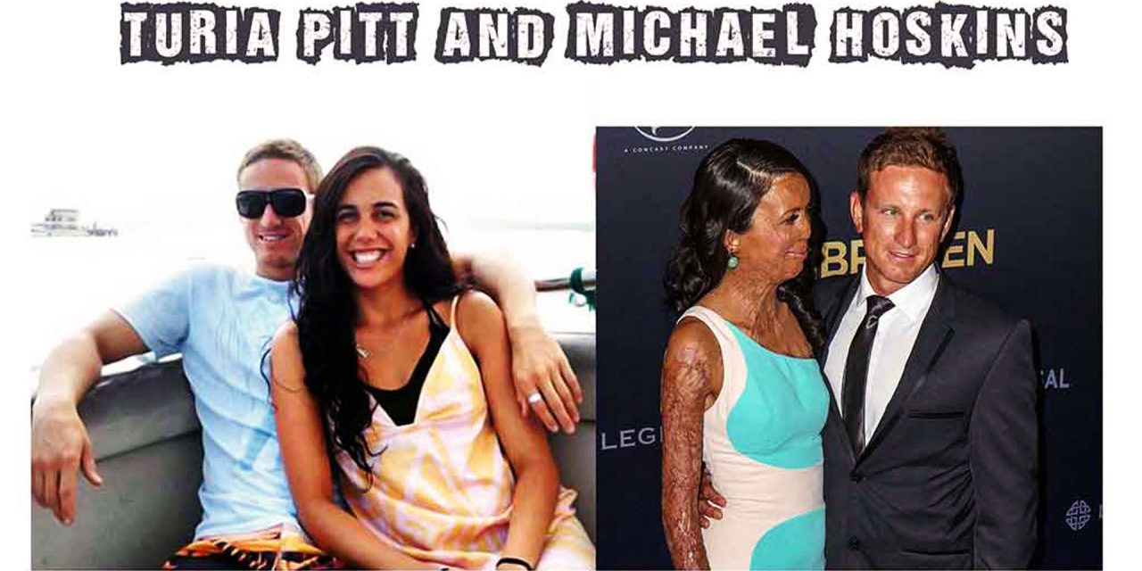 Michael Hoskin And Turia Pitt Story Proves True Love Never Ends