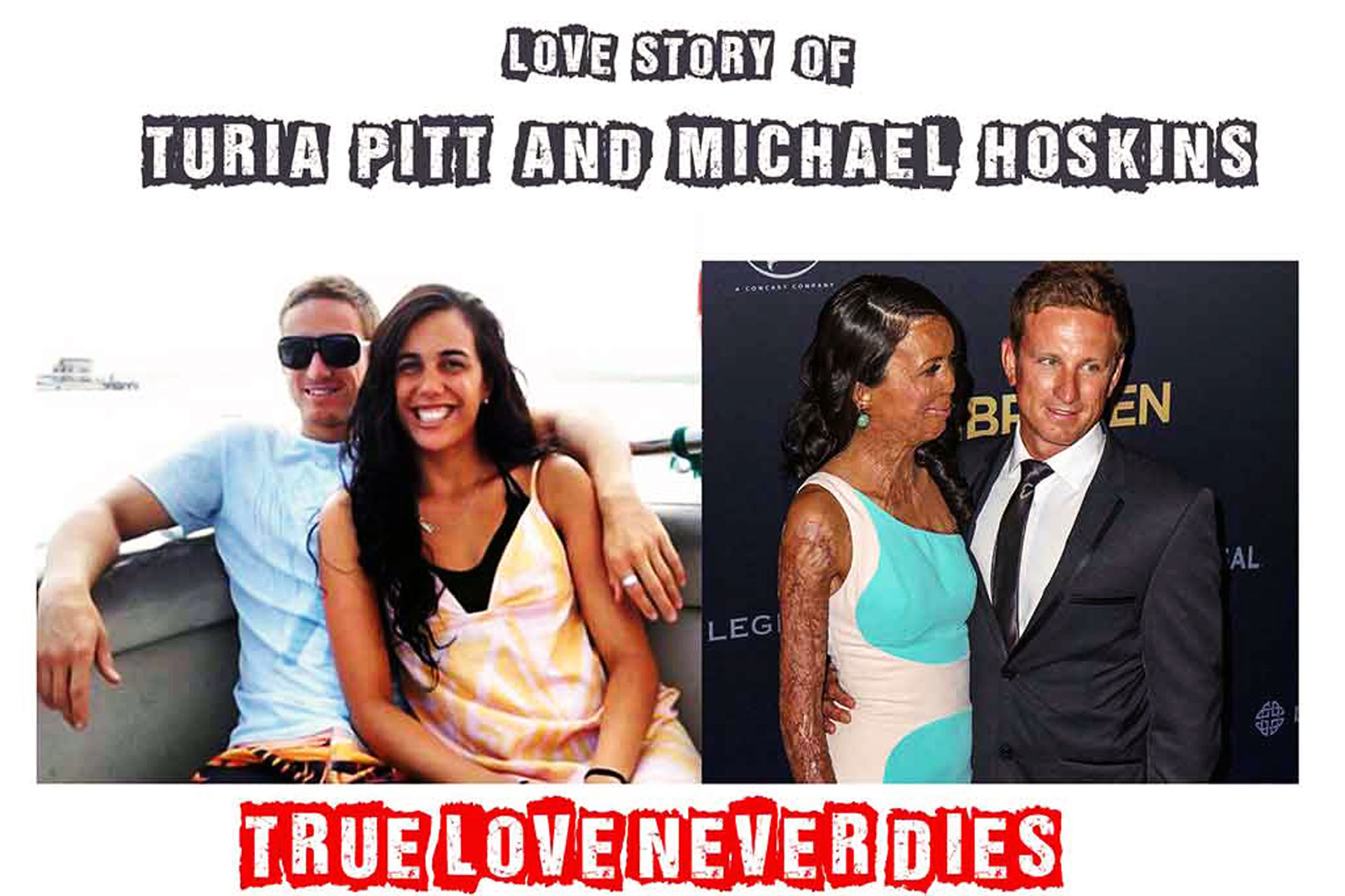 Michael Hoskin And Turia Pitt Story Proves True Love Never 